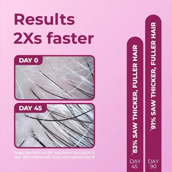 BosleyMD Women's Revive + Densifying Treatment Foam 60-Day Supply, 2.11 oz Bosley MD