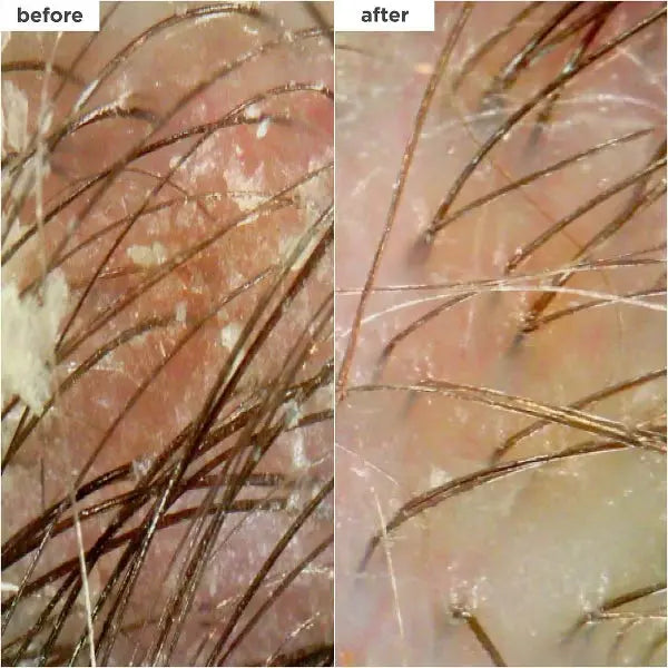 Briogeo Scalp Revival Charcoal + Coconut Oil Micro Exfoliating Scrub 8oz Briogeo