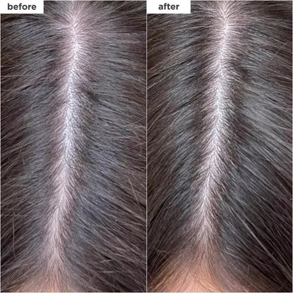 Briogeo Hair Care Scalp Revival Charcoal + Biotin Dry Shampoo 1.7oz Briogeo