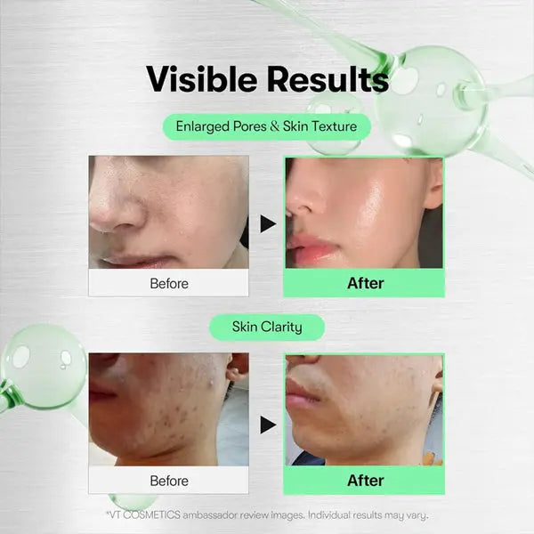 VT COSMETICS CICA Reedle Shot 100 Spicule Microneedling Serum for Pore Care 2 Pack VT Cosmetics