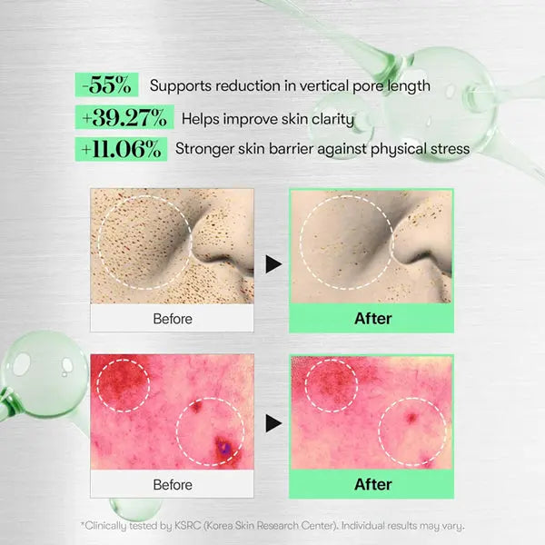 VT COSMETICS CICA Reedle Shot 100 Spicule Microneedling Serum for Pore Care 2 Pack VT Cosmetics