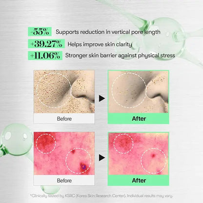 VT COSMETICS CICA Reedle Shot 100 Spicule Microneedling Serum for Pore Care 2 Pack VT Cosmetics