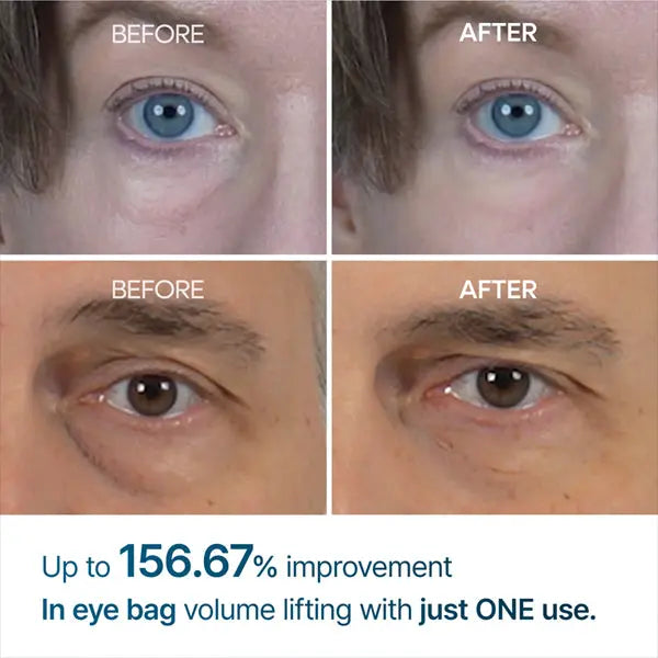Dr. Melaxin Eyephalt Eyebag Cream Due 10g 2 Pack Dr. Melaxin