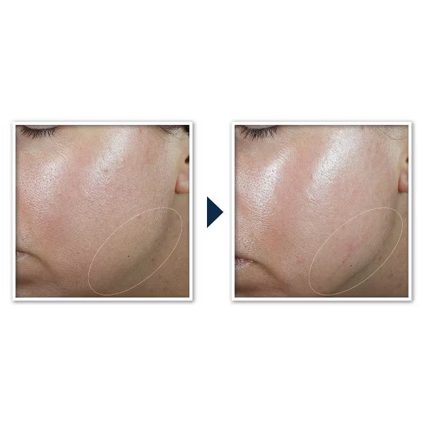 RoC Derm Correxion Contour Retinol Cream for Face and Neck 1.7oz